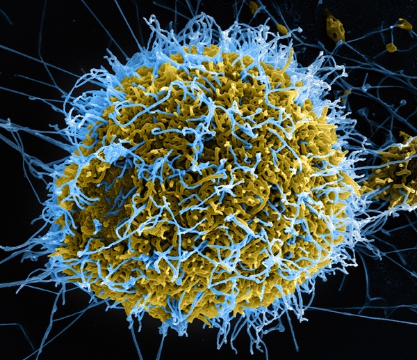 EbolaVirusParticles7