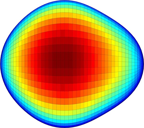 Pear shaped nucleus of an exotic atom