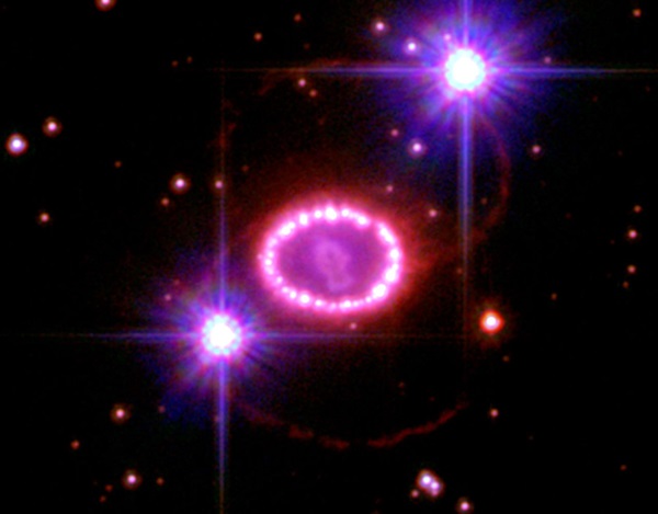 Supernova 1987A and its "String of Pearls"